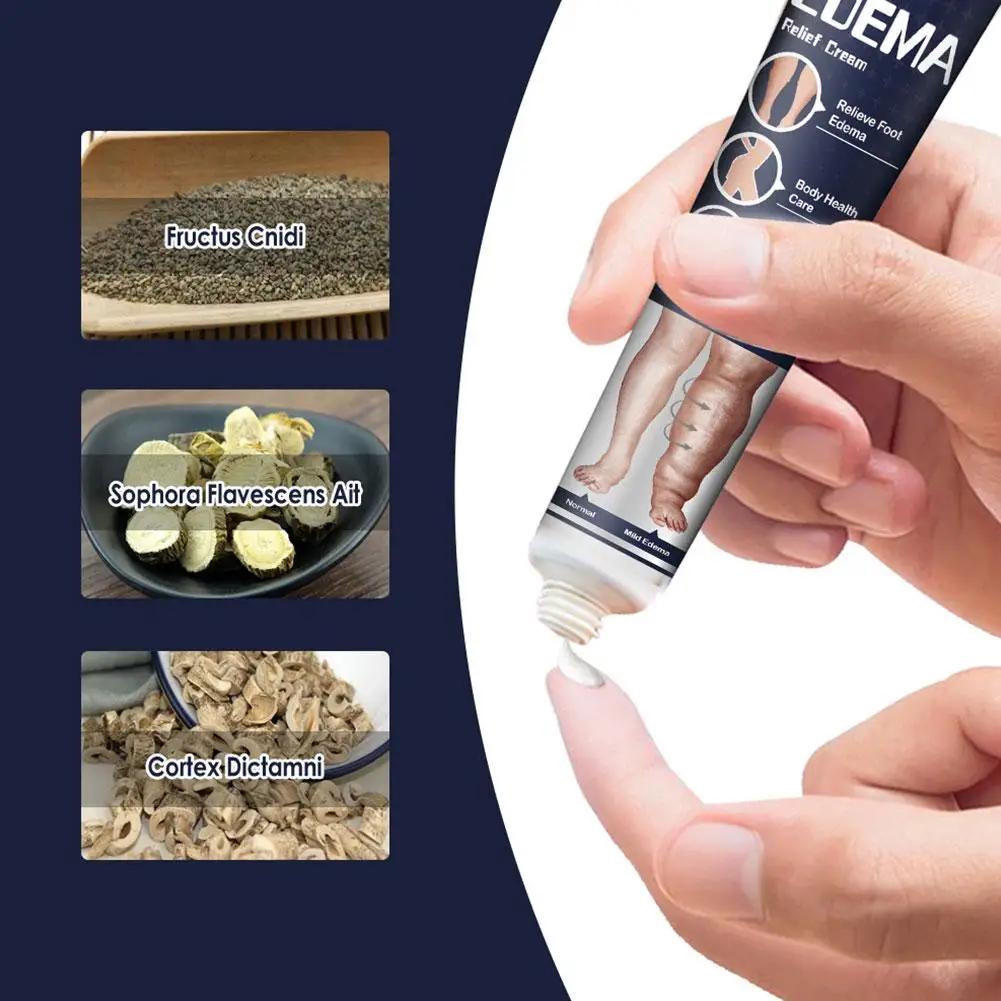 Crema per i piedi anti edema Massaggio ai piedi Crema sanitaria Alleviare efficacemente le vene varicose Braccio Gamba Gonfiore Dolore Crema rilassante