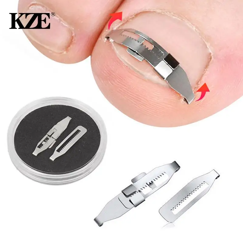 Ingrown Toenail Corrector Tools Pedicure Recover Embed Toe Nail Treatment Professional Ingrown Toenail Correction Foot Care Tool