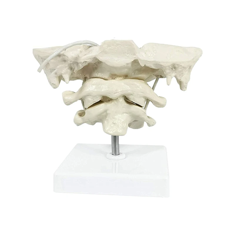 1.5x Magnification Human Cervical Spine Model Occipital Bone Model Medical Teaching Training Aid Dropshipping