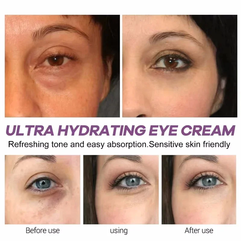 Retinol Eye Cream Stick Anti-aging Anti Wrinkle Firming Moisturizing Puffiness Black And Circles Deep Lightening