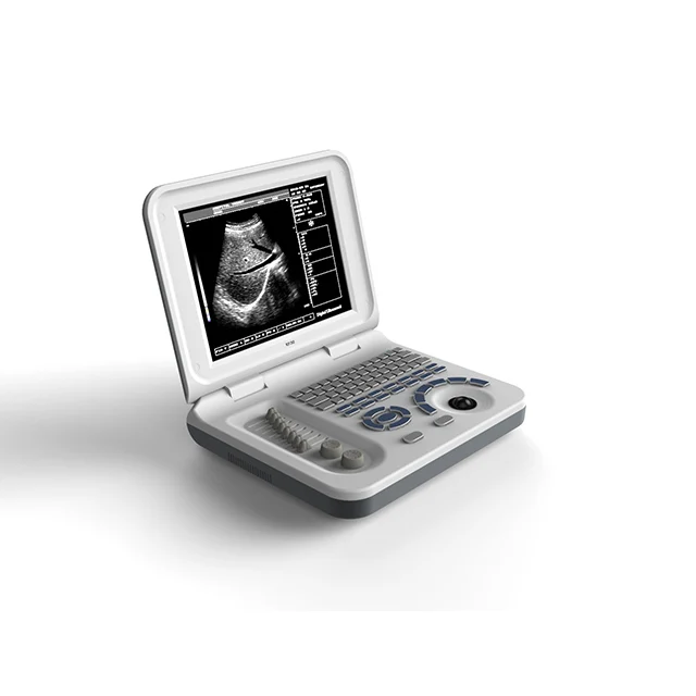 Factory Wholesale Medical Portable Ultrasound Diagnostic Equipment Ultrasound Machine Scanner