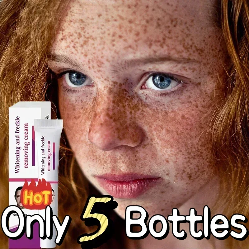 

WhiteningFrecklesCreamRemoveMelasmaDarkSpotsLightenMelaninRemoverMoisturizingBrighteningFaceSkin Care