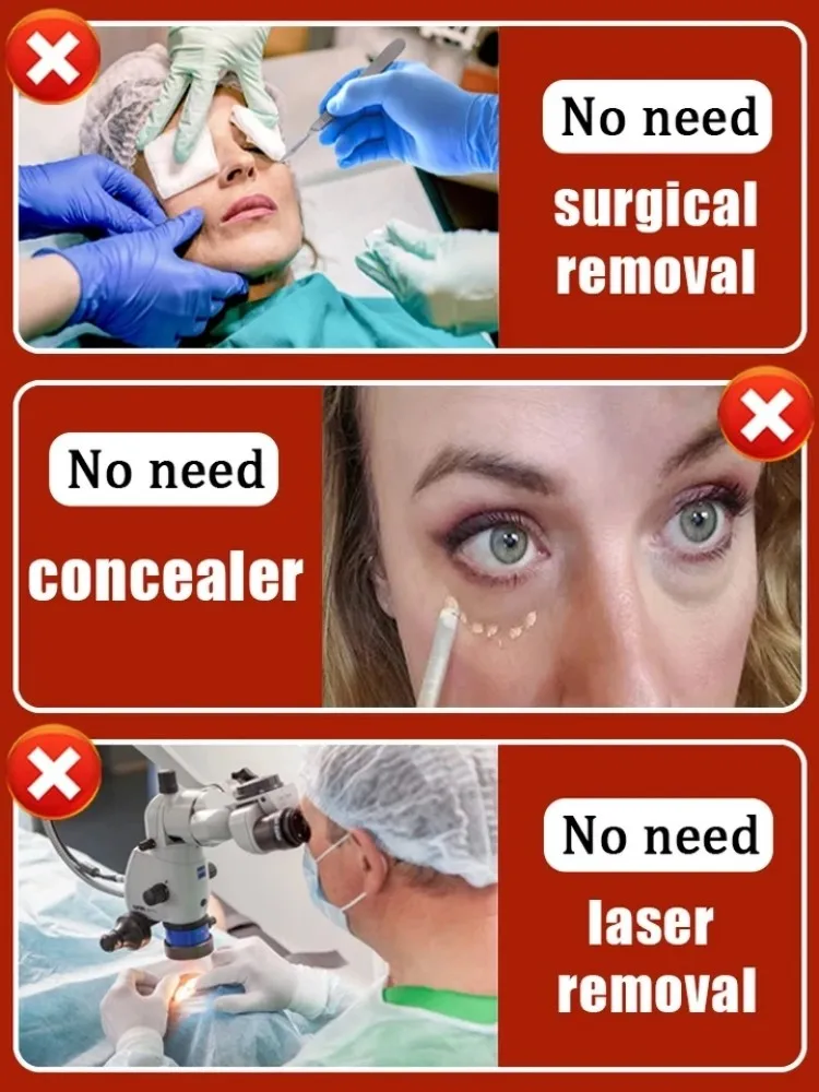 Crema Oxys antiarrugas, crema Facial antiarrugas, Estiramiento Facial antienvejecimiento, masajeadores faciales, producto para eliminar arrugas