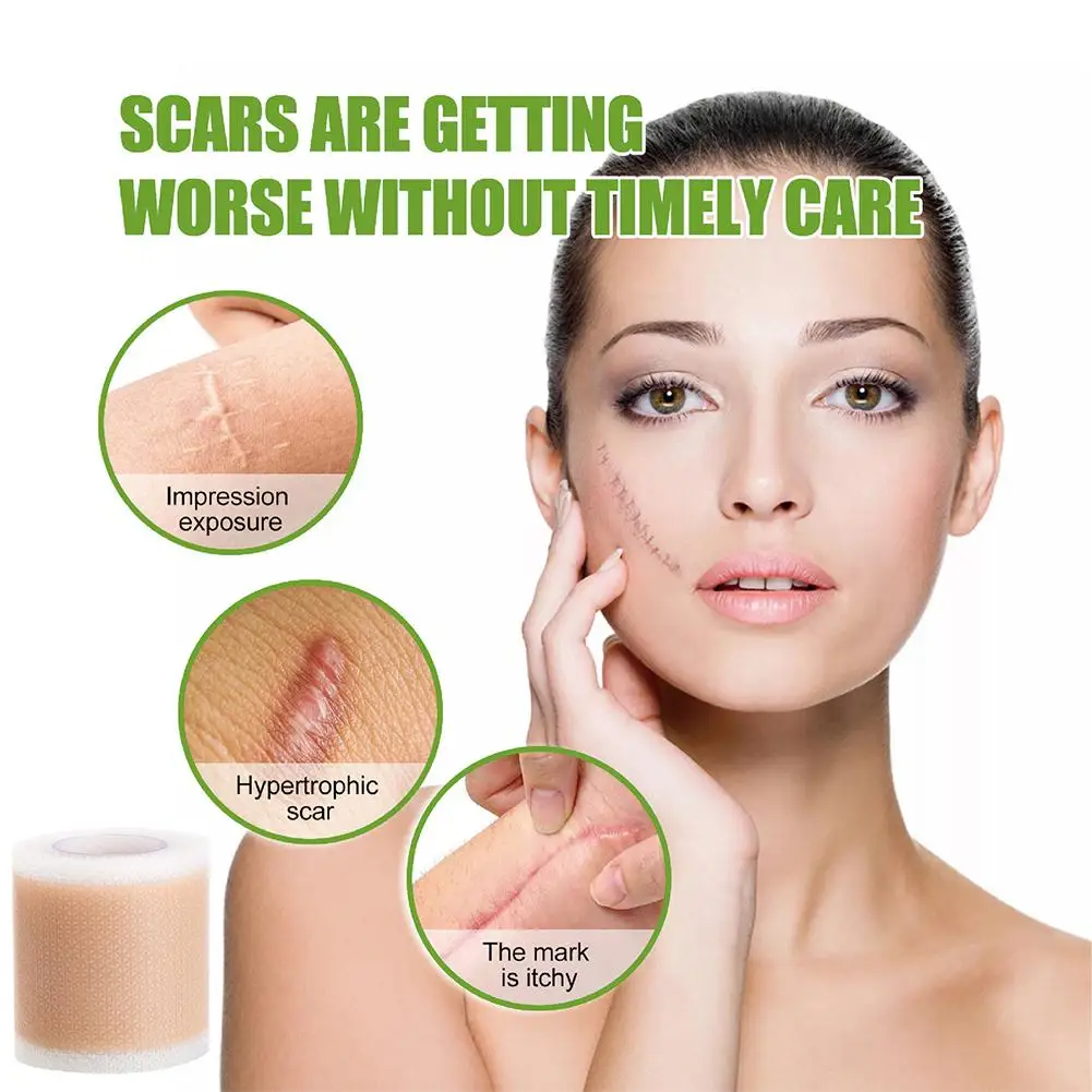 4X150CM Silicone Scar Patch Skin Repair Sheets Removal Self-Adhesive Stretch Mark Tape Therapy Patch Burn Acne Scar Skin Care 