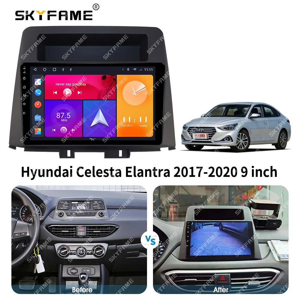 SKYFAME إطار السيارة فآسيا محول أندرويد راديو داش تركيب لوحة عدة لشركة هيونداي إلنترا سيليستا