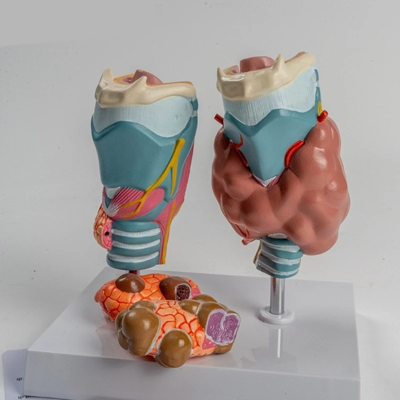 

Human Pathological Thyroid Anatomy Model With Removable Parts, Anatomical Auditory Organ Model For Lecture Report Dropshipping