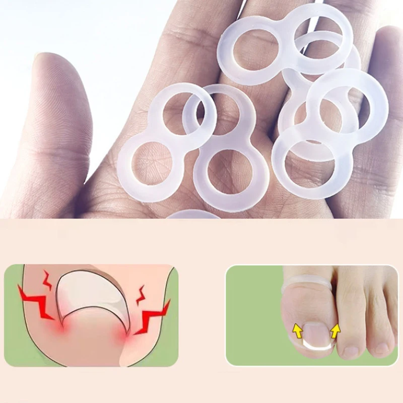 Silicone Ingrown Toenail Correction Pads Tool Invisible Ingrown Toe Nail Treatment Elastic Straightening Clip Brace