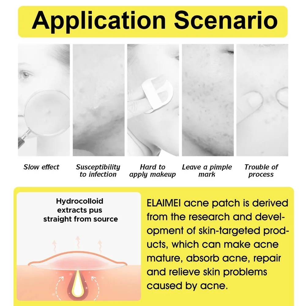 إزالة حب الشباب الغروانية المائية الكبيرة بقع بثرة الوجه بالكامل للأنف والذقن والجبهة والخد وحماية البشرة وتنظيف الوجه