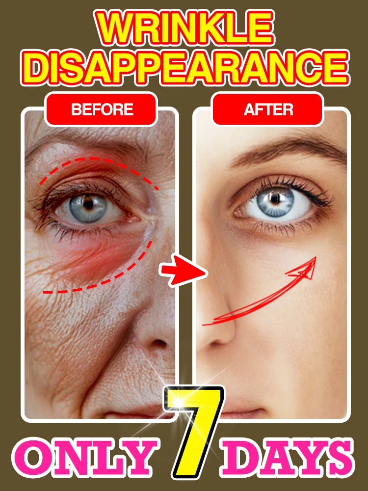 Face-lift Slimming Cream Slimming Firming V-Shape Removal Masseter Muscle Double Chin Face Fat Burning  Products