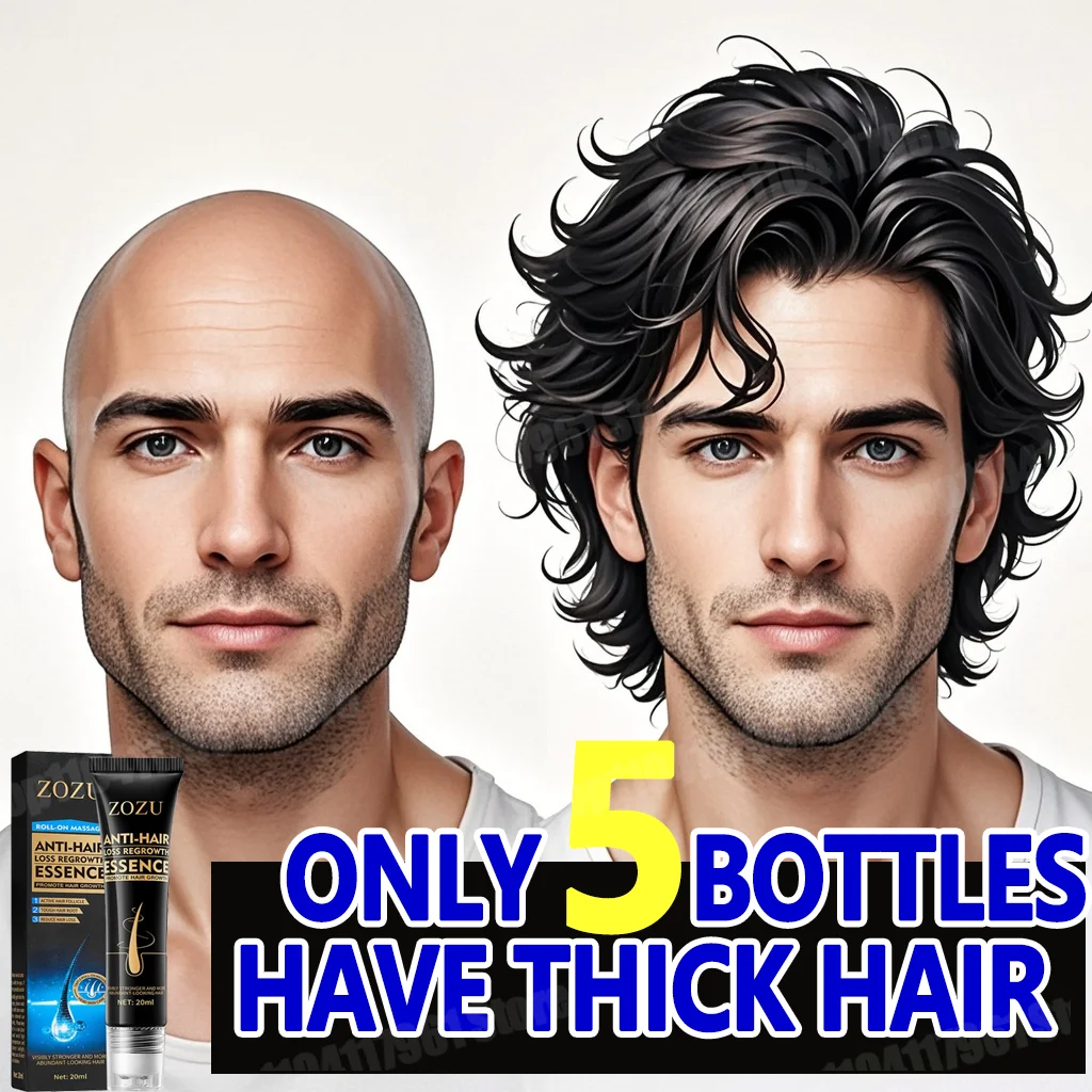 

2, биотинное масло для быстрого роста волос, средства для ухода за кожей головы, средства для массажа кожи головы, против выпадения волос, эффективное роста, гуще, сыворотка для волос для мужчин