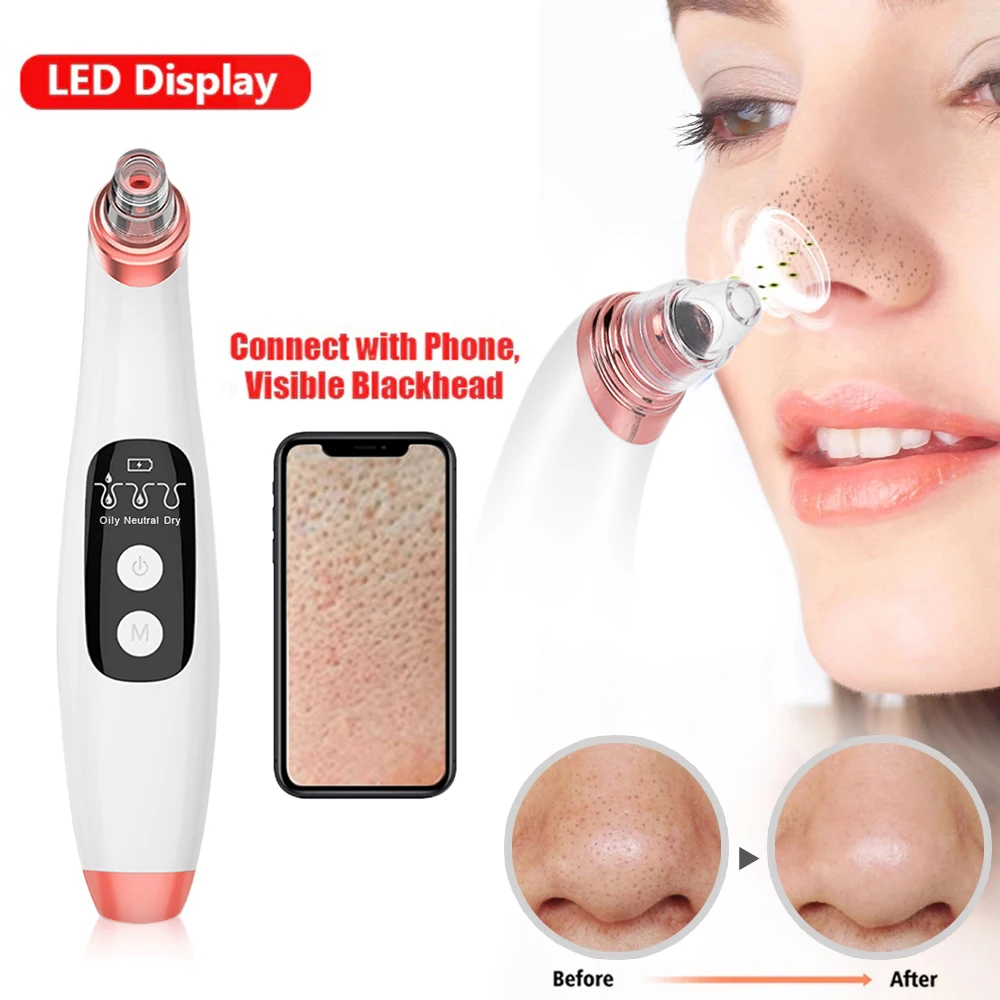 Visuele poriereiniger 20-x vergroting Zuig Facial Comedo Acne Extractor Tool Mee-eterverwijderaar Vacuümcamera