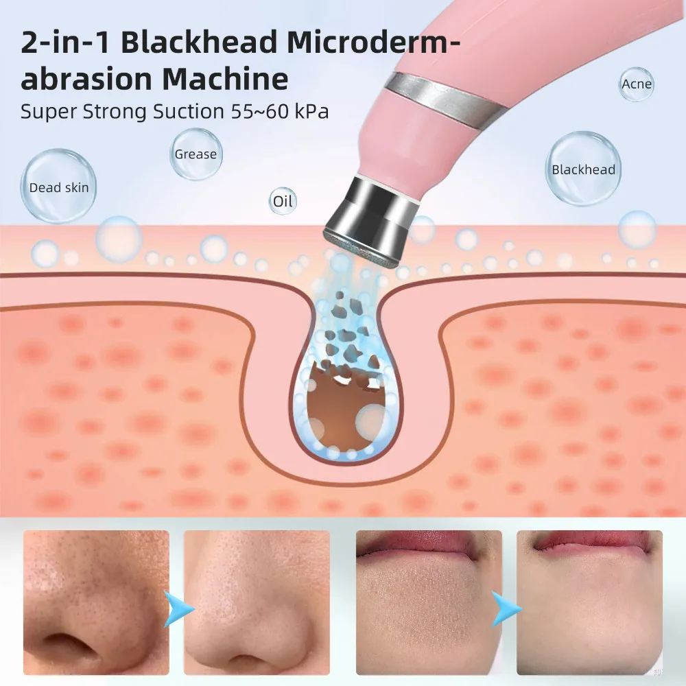 Portable Diamond Microdermabrasion Machine For Facial Peeling Skin Care Blackhead Removel Acne Clearning Skin Rejuvenation SPA