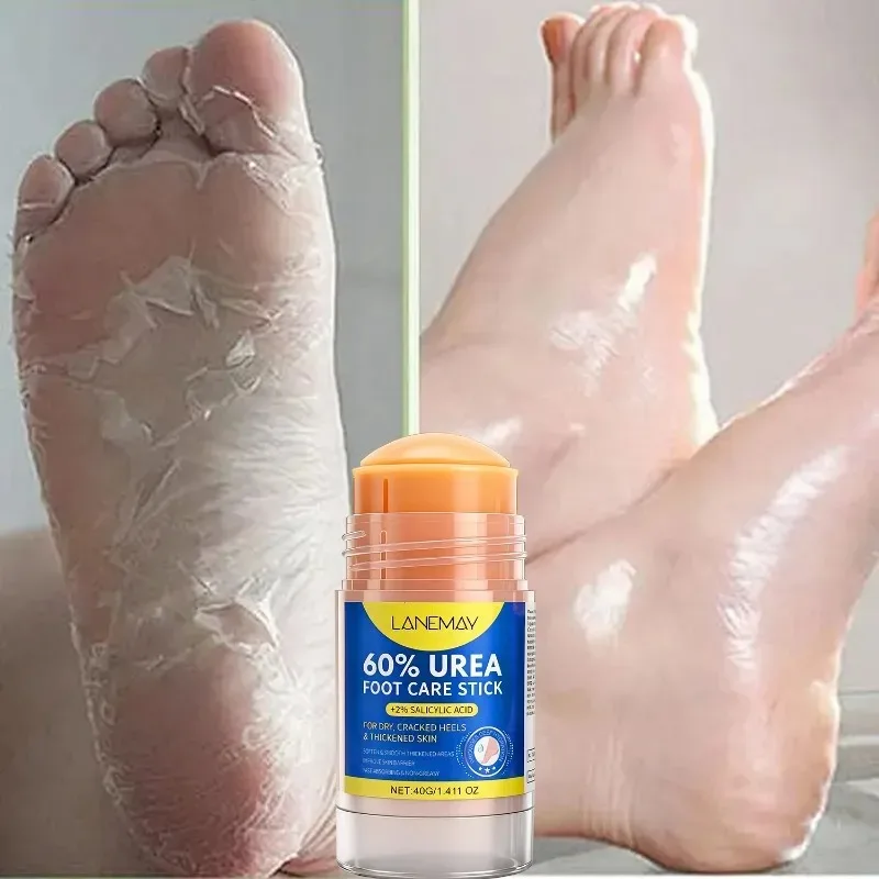 水分補給保湿フットクリーム乾燥ひび割れかかとひび割れ防止足保護クリーム皮膚修復インテンシブハイドラカルスリムーバー40g