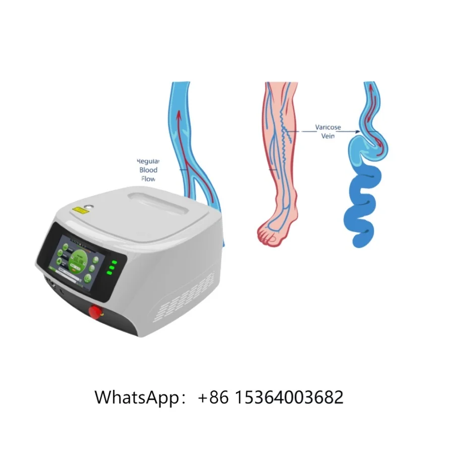 

980nm 1470nm EVLT Endovenous Laser Ablation Equipment for Varicose Veins