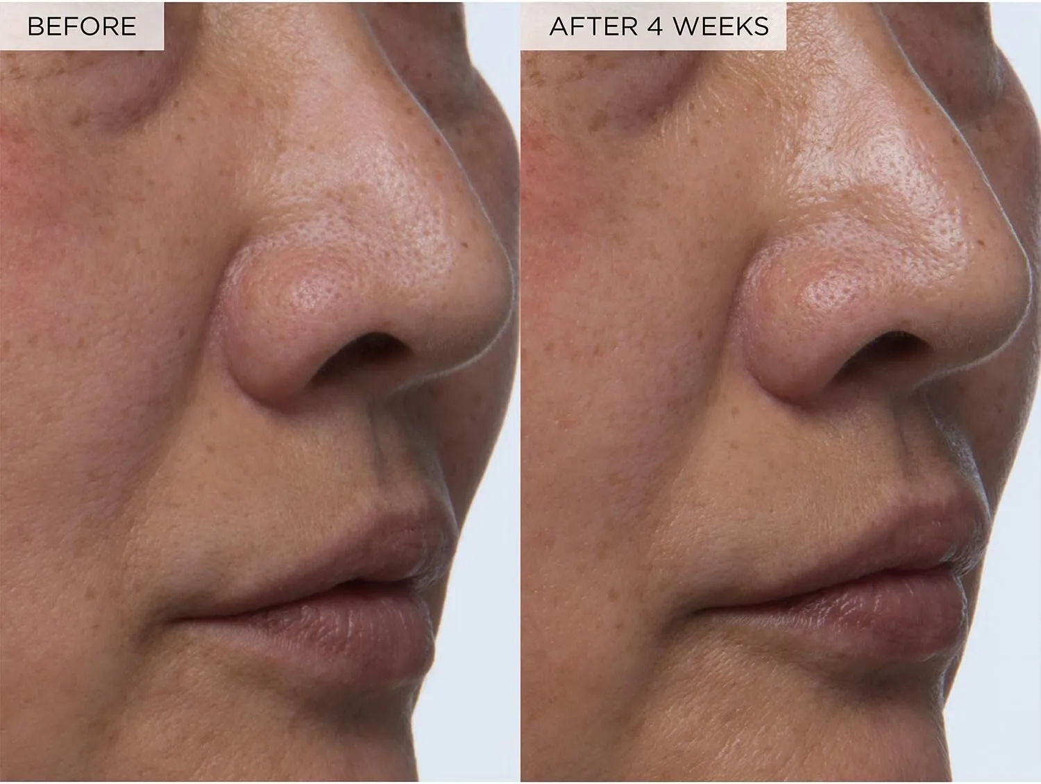 グロウレシピ PHA + BHA フェイストナー - 韓国スキンケア化粧水、毛穴縮小＆フェイシャル