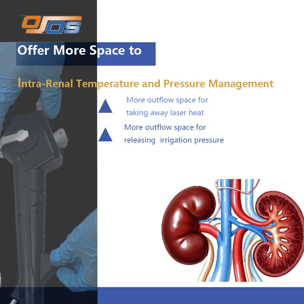 2.1mm Urethra Adult Flexible Disposable Ureteroscope 6.3FR 720x720 Resolution USB Interface CE Certified Urology