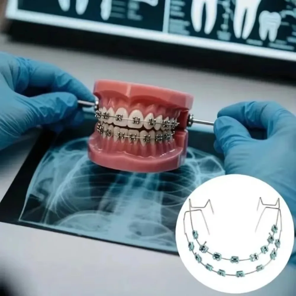 High Quality Fashion Braces Colorful 1 Pair Temporary Tooth Decoration with Metal Wires Metal Bracket Orthodontic Ligature Ties
