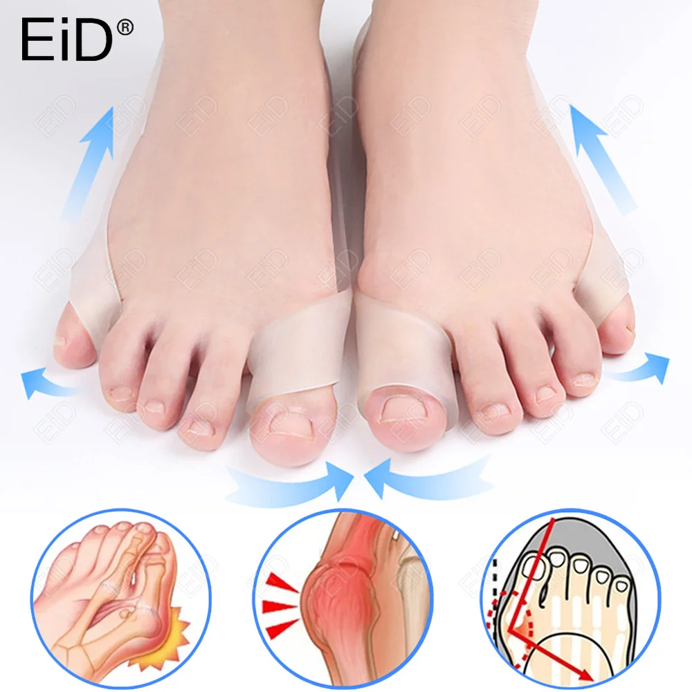 Siliconen Grote & Kleine Tenen Separator Bunion Bone Ectropion Richter Tenen Buitenste Appliance Voetverzorging Gereedschap Hallux Valgus Corrector