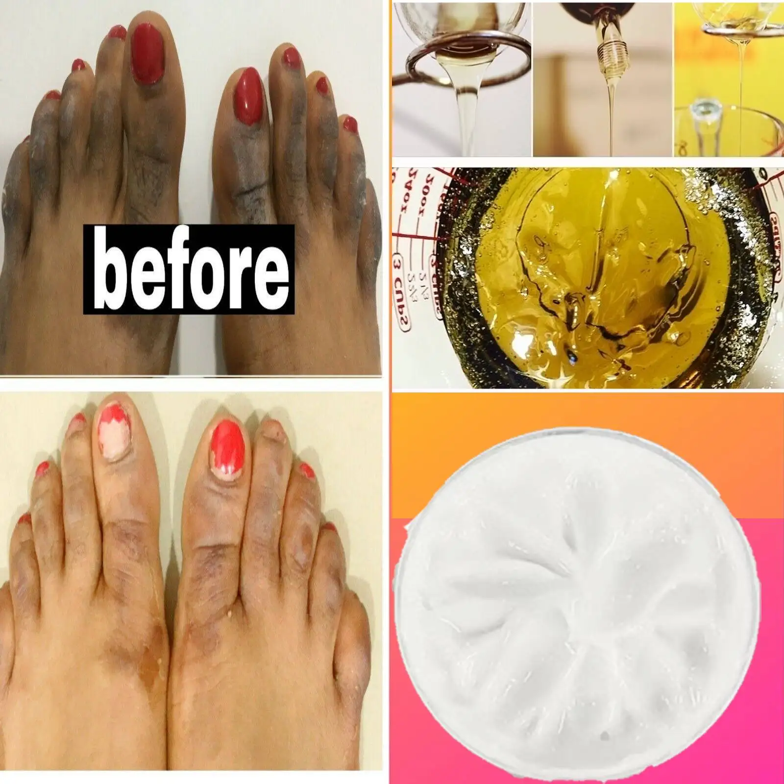 Fast Feet lightening cream , Spotless feet, Fast action , Fast results Remove Dark Skin Lightening Bleaching Body Skin Kojic AHA