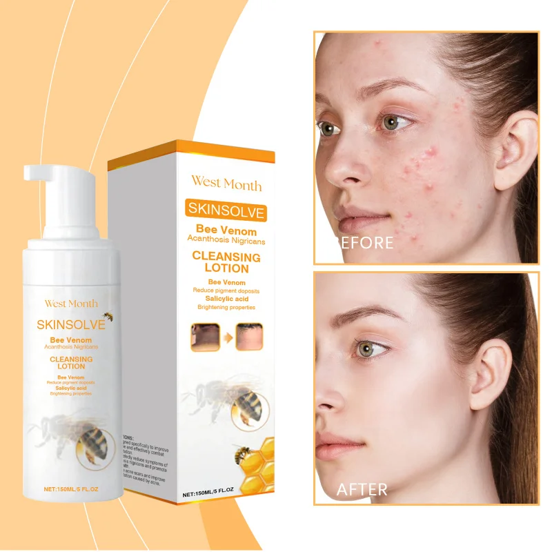 

Gentle Facial Cleanser For Thorough Face Cleaning, Oil - Balancing & Long - Lasting Skin Refreshment, Suits Daily Routine