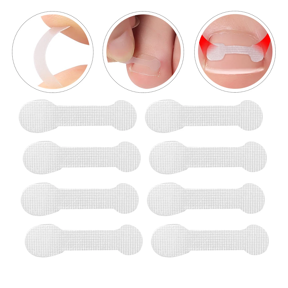 

30pcs Toenail Orthopaedic Stickers Resin Corrector Patch Bunions Pain Relief Hallux Care Healthy Nails Flexible Fabric