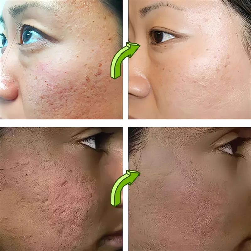 Clean Pores Serum Facial Delicate Tender Moisturizing Oil Control Shrink Pores Rough Skin Smooth Care Brighten Korean Cosmetics