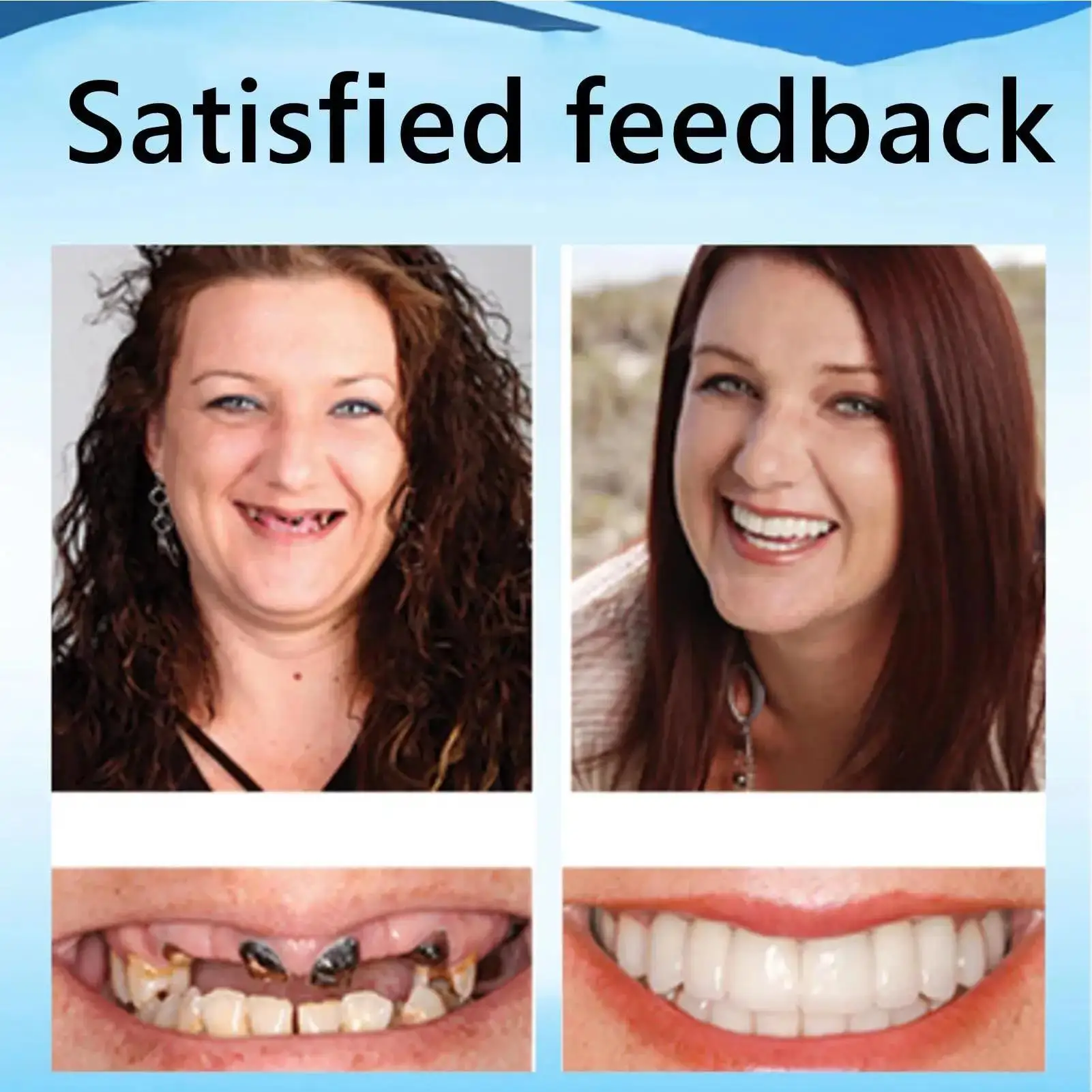 

Лидер продаж: Набор для восстановления зубных протезов из натурального силикона, легко наносимый, для верхних и нижних зубов, комфортный, CK848-FRO