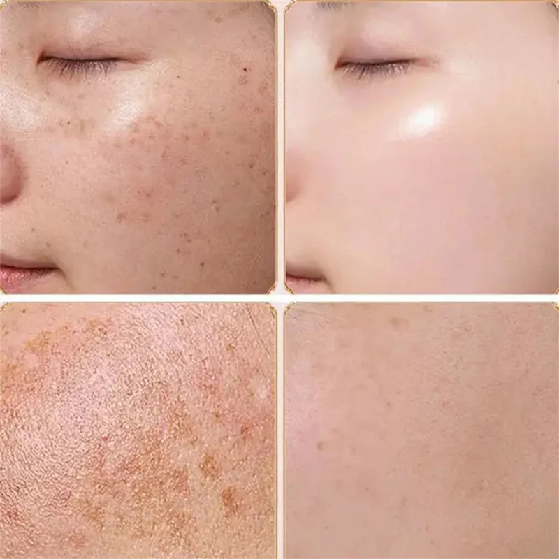 米と蜂蜜のクレンジングフェイスマスク、ブライトニング美容液、化粧水、保湿ブライトニングオイルコントロールギフトセット、女性用スキンケア、韓国製