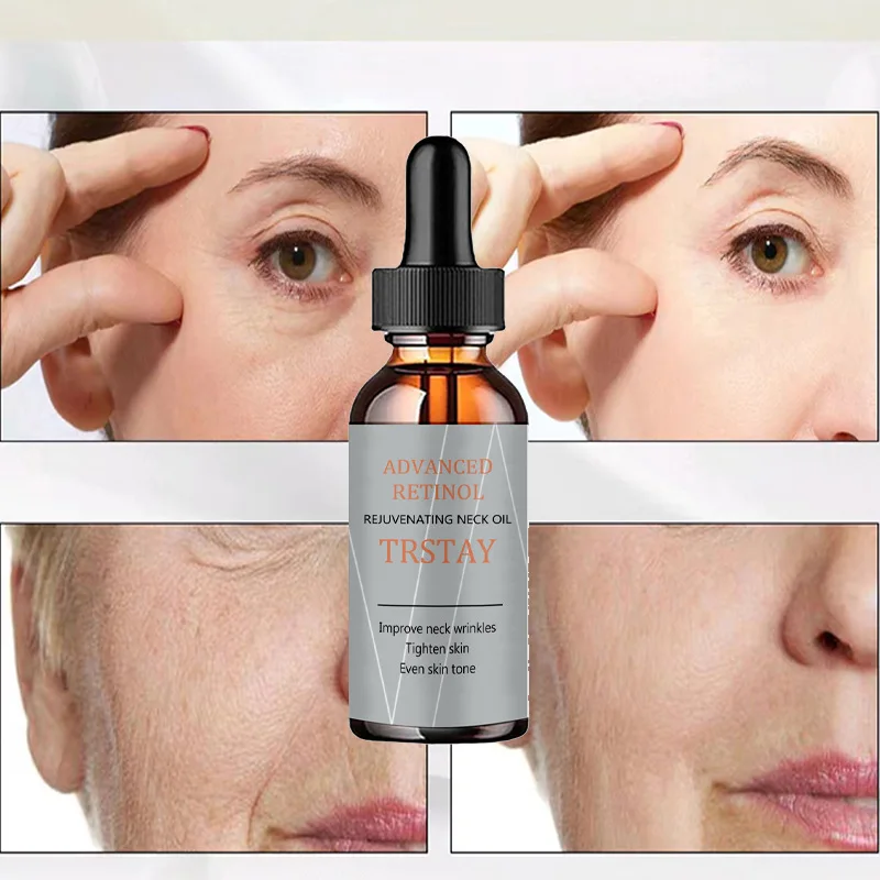 5ML/15ML/30ML/50ML/ Improve facial Remove stains, plaques, and smooth skin Improve neck wrinkles and tighten skin