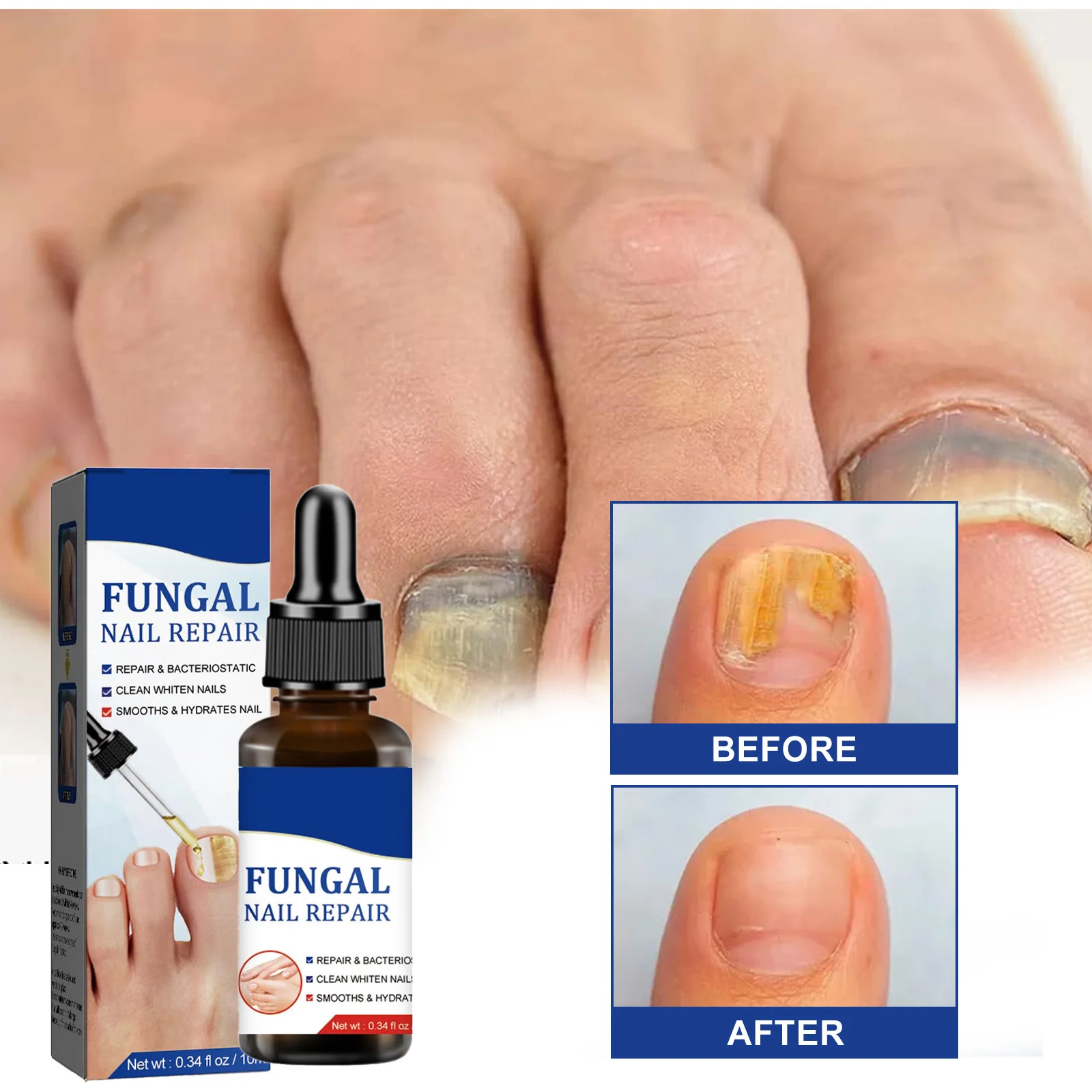 Nail Fungals Renewal Nail Repair Liquid for Discolored Thickened Crumbled Nails Nail Fungals for Discolored Broken Cracked BS.44