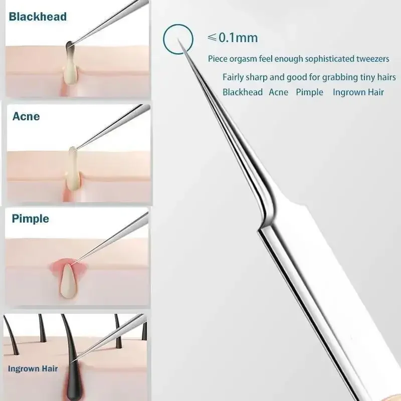 11Pcs Ingrown Hair Tweezers Acne Blackhead Removal Needles Black Dots Cleaner Pore Cleaner Deep Cleansing Face Skin Care Tools