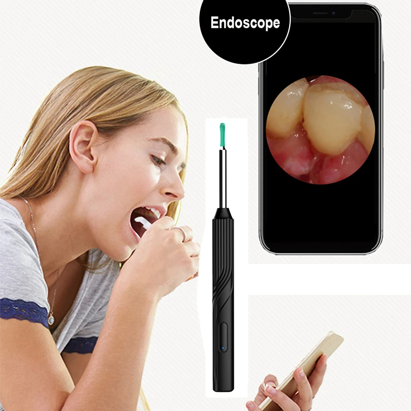 طقم منظار الأذن اللاسلكي المحمول ، طبيب طبي منزلي ، منظار الأذن والعناية بالأذن ، سماعة الأذن LED ، منظف الأذن ، كاميرا بصرية ذكية ، USB ، NE18 #4