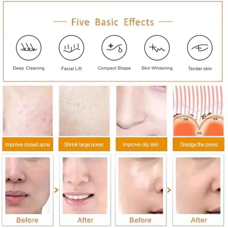 4 EM 1 Aqua Jet Peel Spa Infusão de Oxigênio H2O2 AquaSure Purificador de Pele Pequena BUBLA Dermoabrasão Máquina Facial