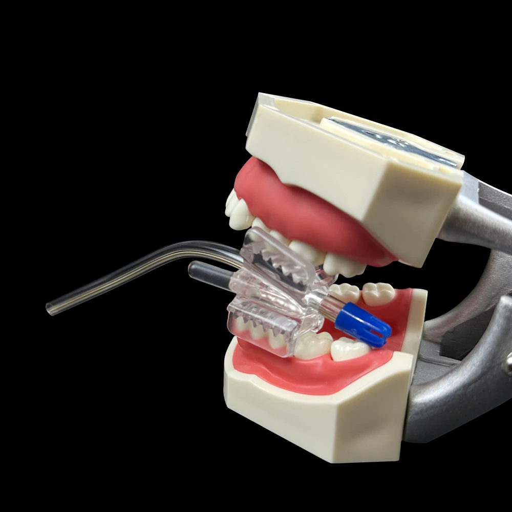 2pcs Dental Silicone Mouth Support Holding Saliva Ejector Suction Tip Occlusal Pad Mouth Opener Retractor Oral Hygiene Material