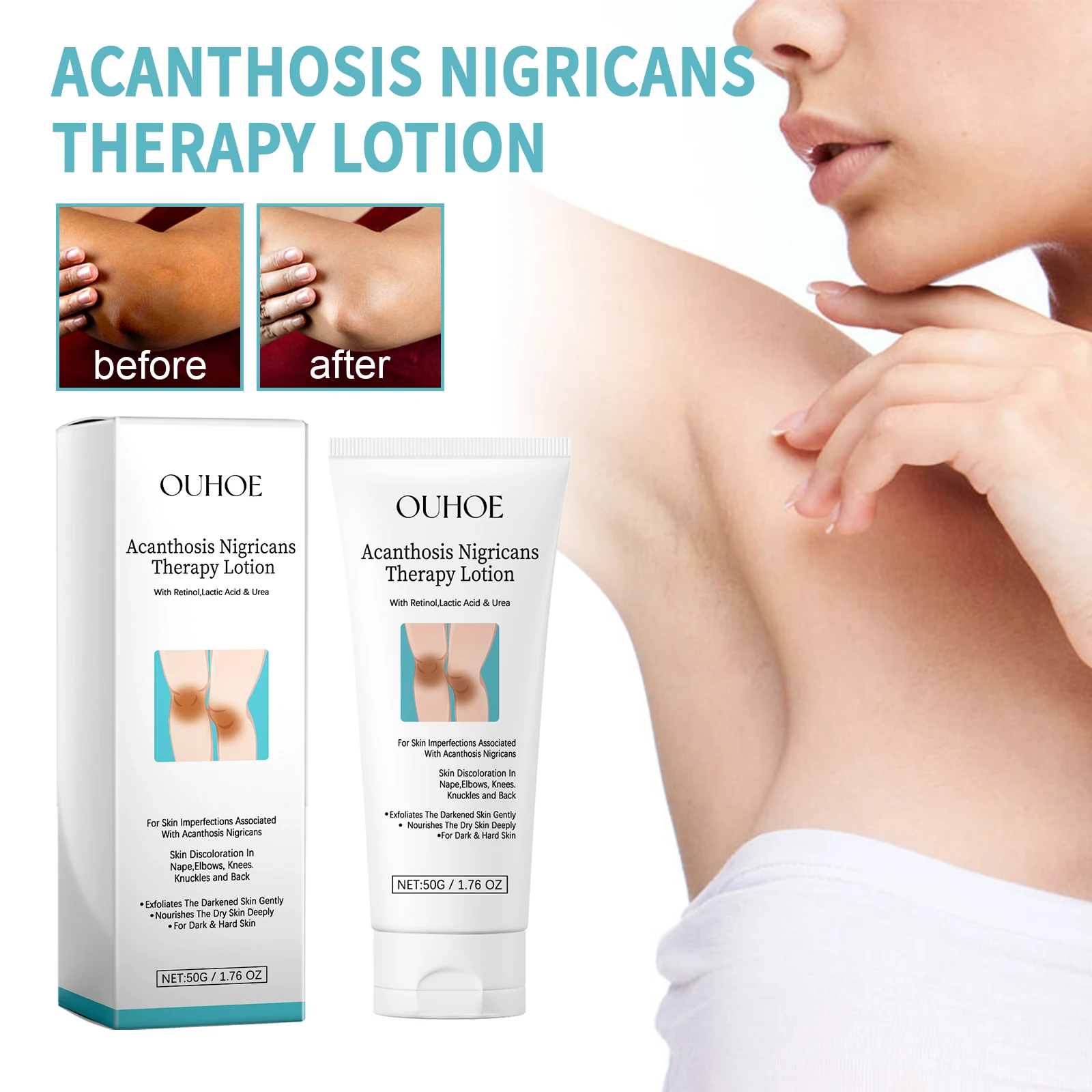 

OUHOE Black Spiny Skin Repair Milk for Dimming Armpits, Elbows, Knees, Melanin Moisturizing, Brightening Skin Body Lotion