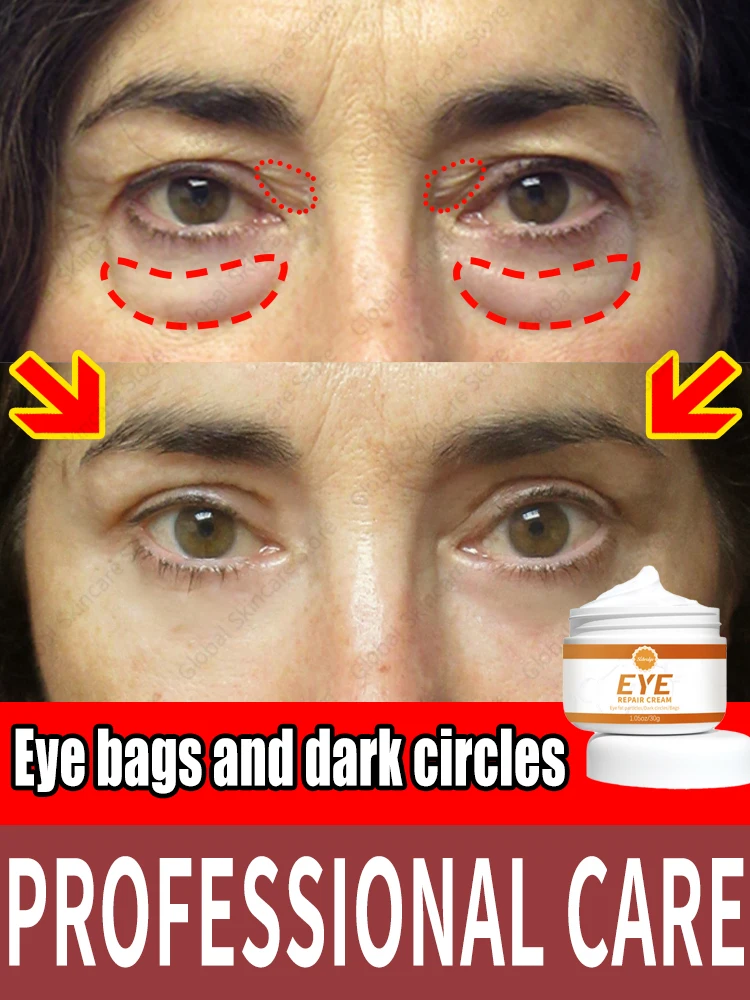 

Fixing Problems Around Eyes