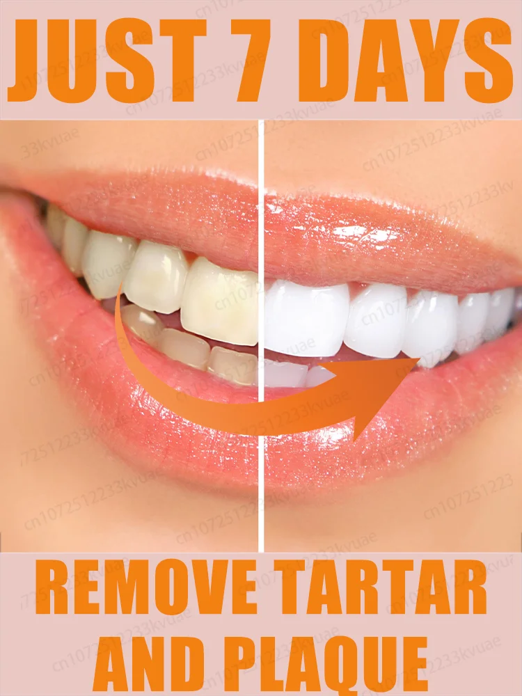 

Sᴄɪᴇɴᴛɪғɪᴄ Rᴇᴘᴀɪʀs Cᴀᴠɪᴛɪᴇs, Cʟᴇᴀɴs Pʟᴀᴏ̨ᴜᴇ, Wʜɪᴛᴇɴs Tᴇᴇᴛʜ