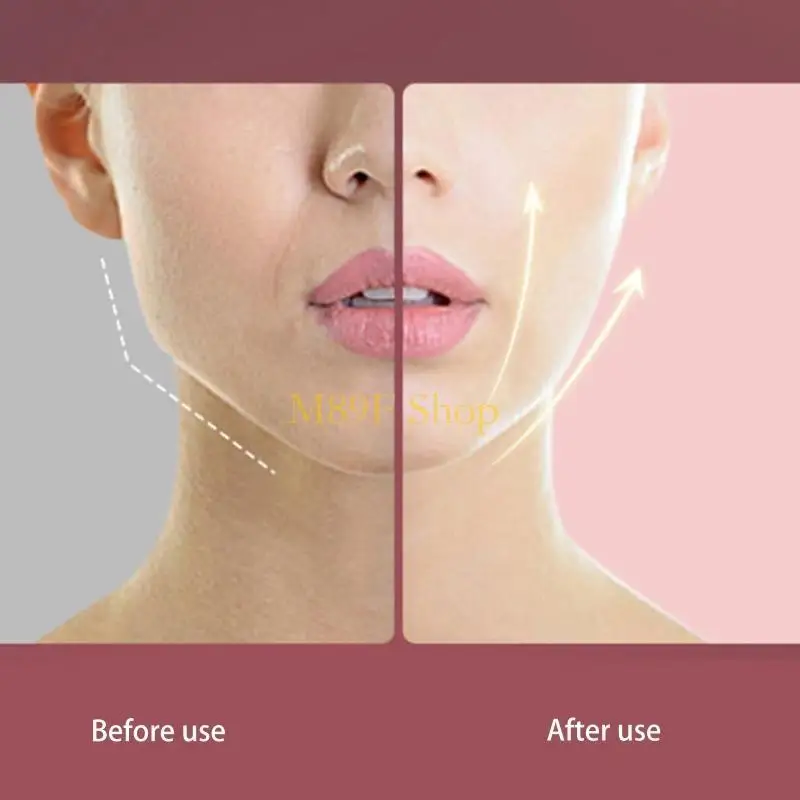 M89F V Máquina face forma V, Máquina correia elevação face, Máquina terapia fótons LED