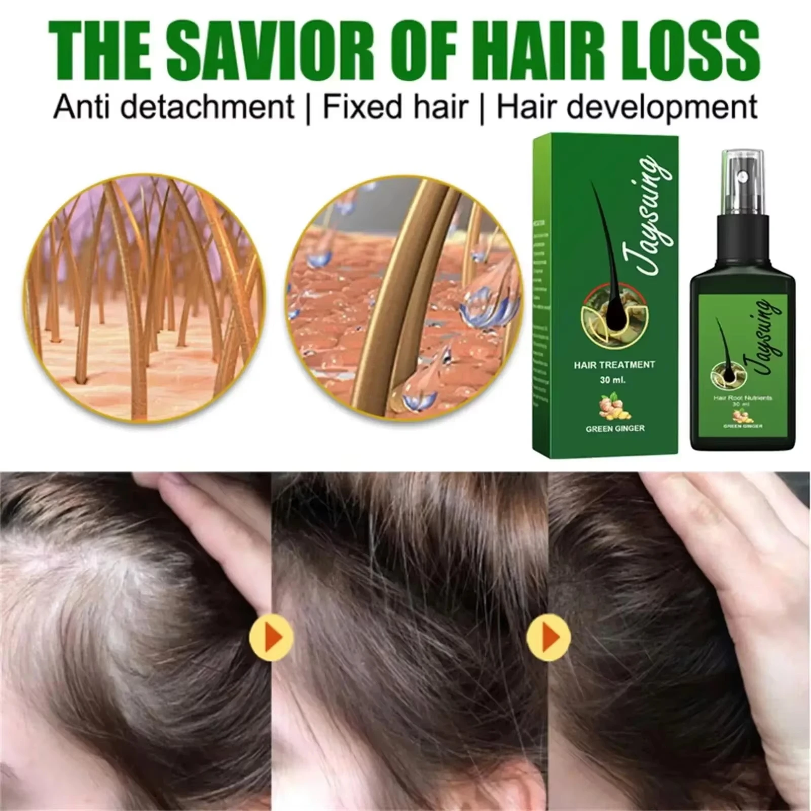 Fast Hair Growth Serum Spray Anti Hair Loss Prevent Baldness Scalp Treatment Repair Roots Beauty Health Hair Care For Men Women