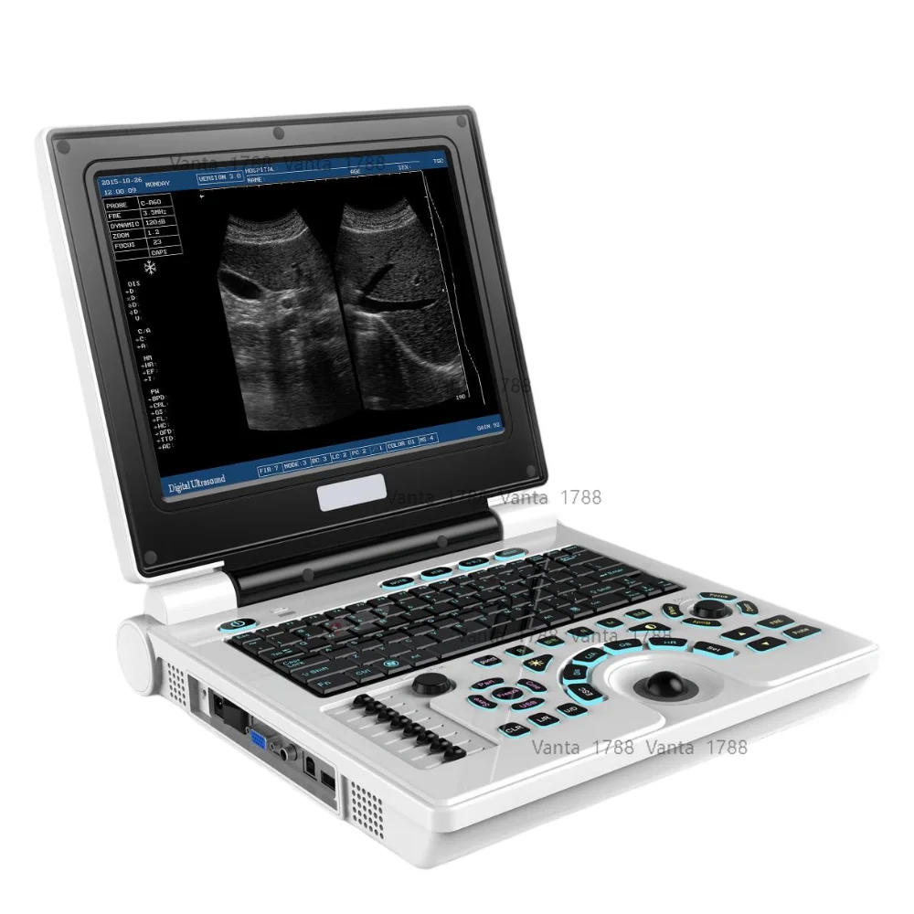 

Por Digit Scanner Convex Probe Laptop Operated Vet Scanner Electricity Power Source