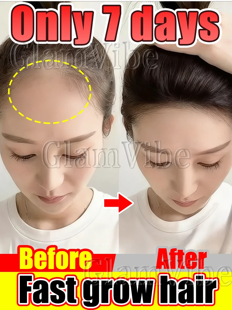 

L̲e̲t̲ y̲o̲u̲r̲ h̲a̲i̲r̲ grow upwards like a tree,sᴛᴀɴᴅɪɴɢ ᴛᴀʟʟ ᴀɴᴅ ᴜɴʏɪᴇʟᴅɪɴɢ.