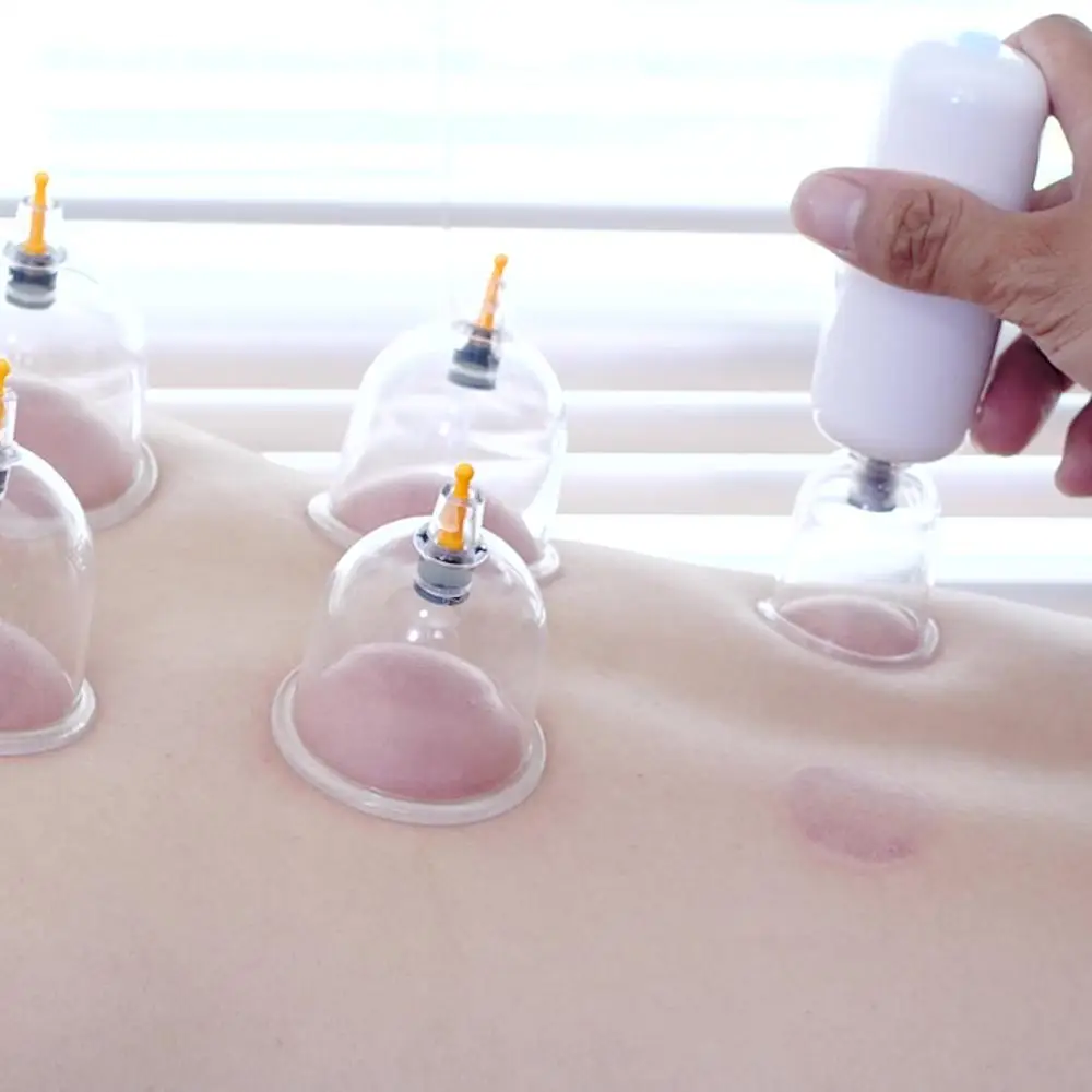 

Hot ** Price Smart Charging Electric Cupping Therapy Massager