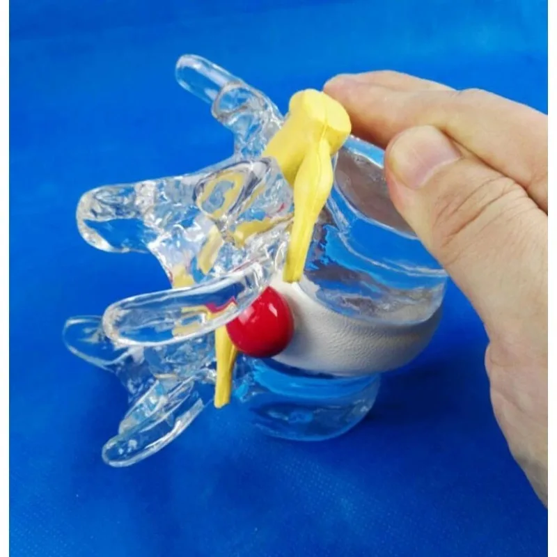 

Анатомический позвоночник, скелет, анатомия, дегенеративный Поясничный диск, герниация, демонстрационная модель, медицинские средства для позвоночника