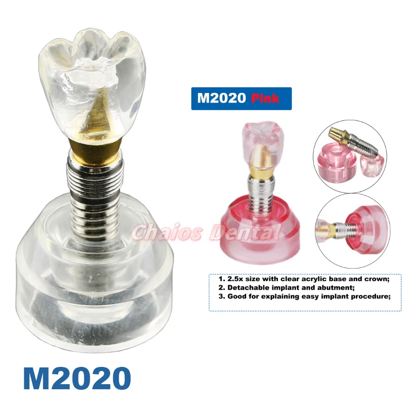 M2020 Implant Model Dental Teeth Model Teaching Models Removable Dentistry Model Teeth For Training Studying Patient Education