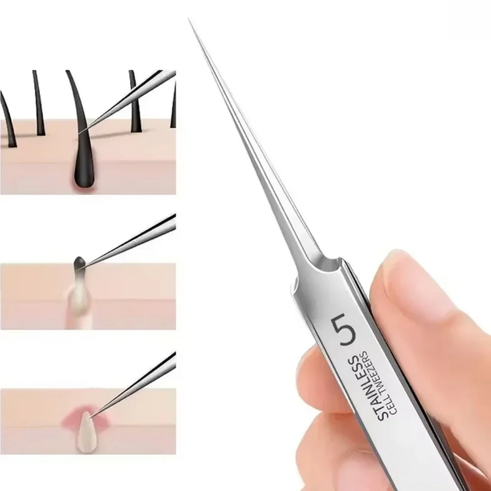 Pinzette di precisione per punti neri in acciaio inossidabile - Strumento per la rimozione dell'acne per la cura della pelle del viso Kit di bellezza professionale per estrattore di comedoni