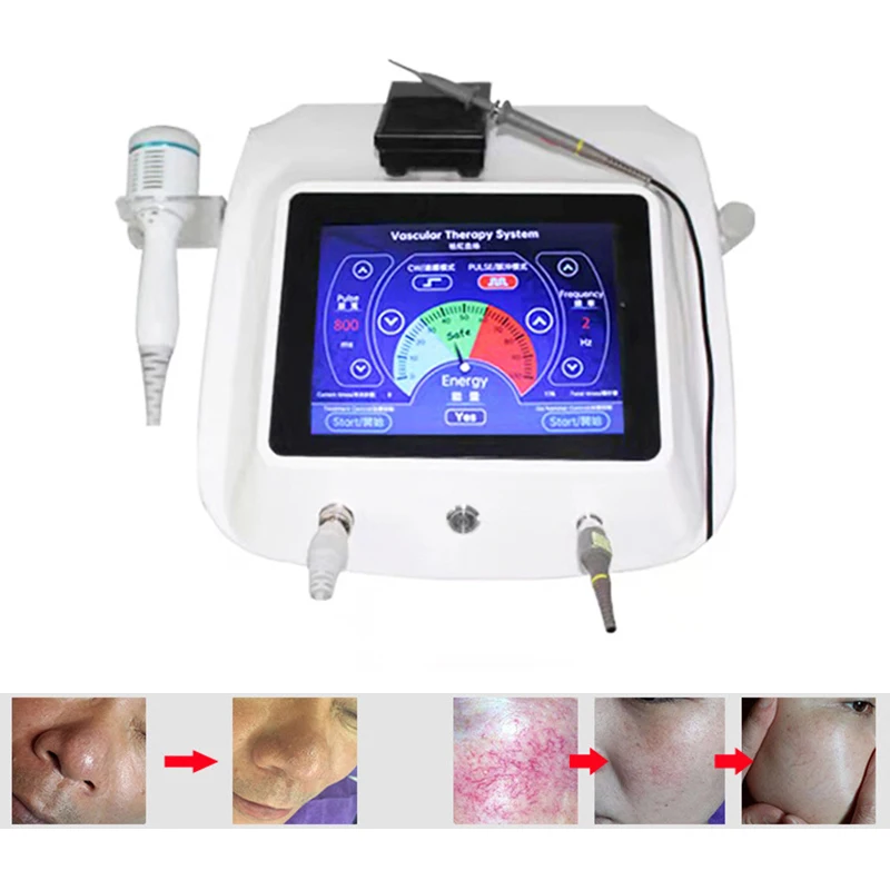 Painless Blood Vessel Spots Vascular Removal Beauty Equipment High Frequency Needle RF Spider Veins Removal Anti Redness Machine