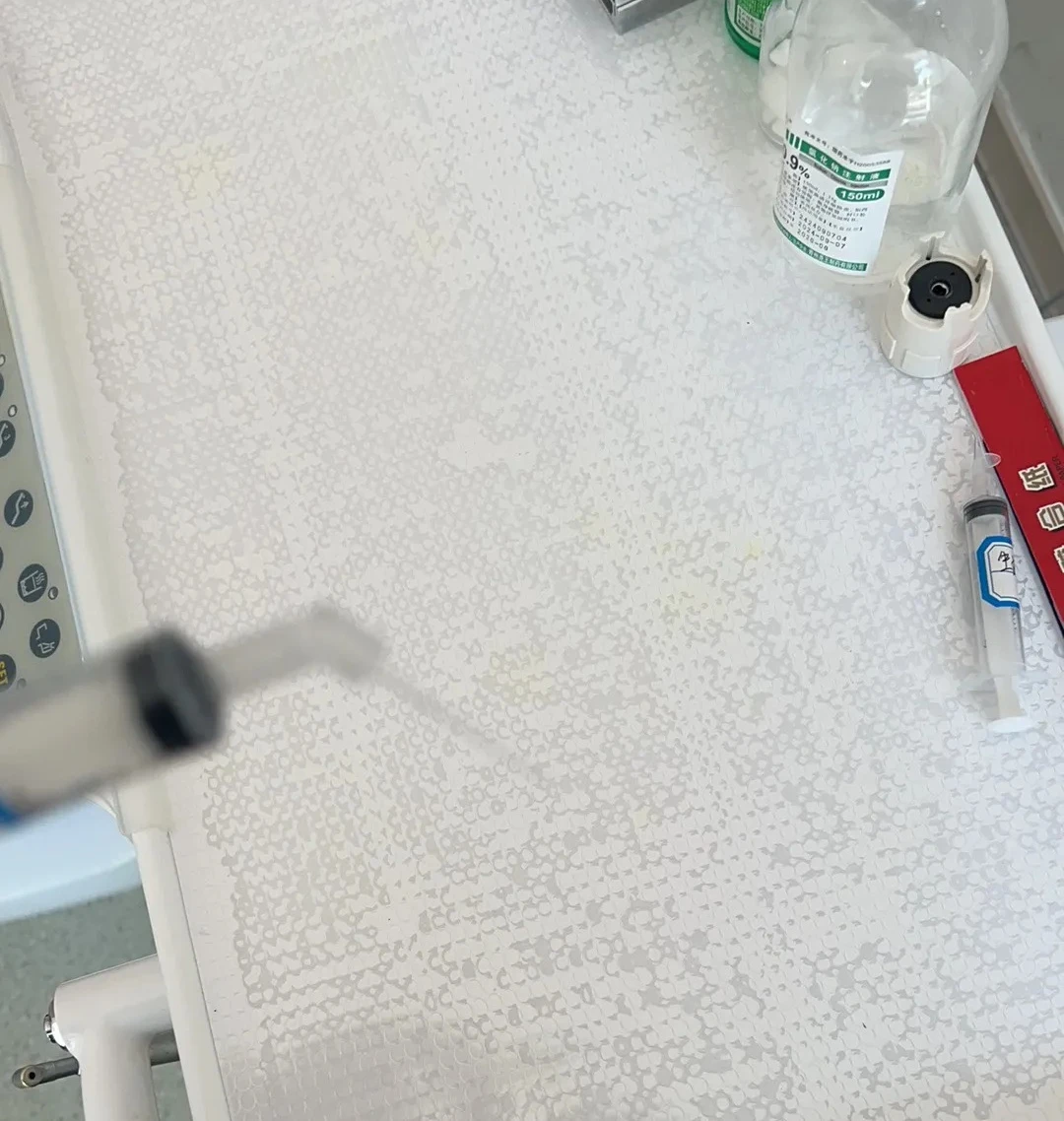 Dental PD Disposable Flushing Needle with Double-sided Opening Flushing Needle That Can Be Flexibly Moved for Dental Materials