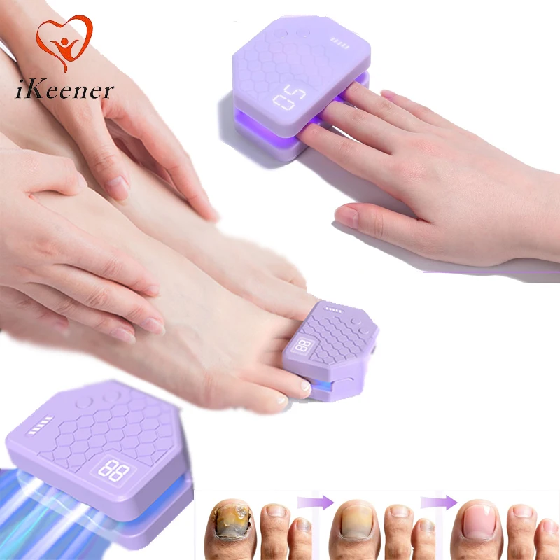

Nail Fungus Laser Therapy Device 905nm Infrared Laser 660nm 470nm Three-finger Wireless Anti Fungal Onychomycosis Toenail