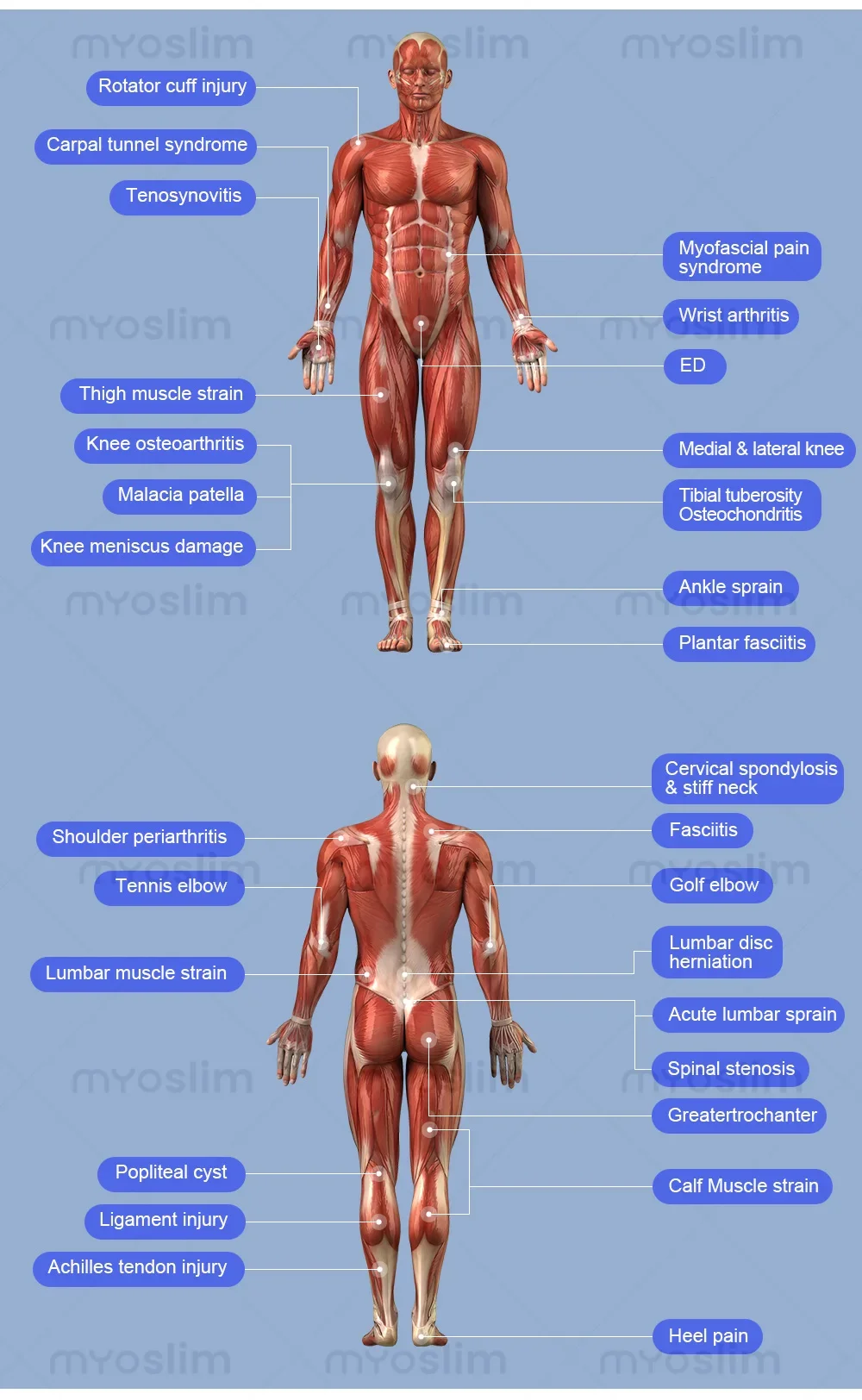 Tragbares Professionelles Physio-Magneto PEMF Magnetotherapie-Gerät - Neueste Schmerzlinderung und Therapie für Sportverletzungen in der Physiotherapie – Detail 13