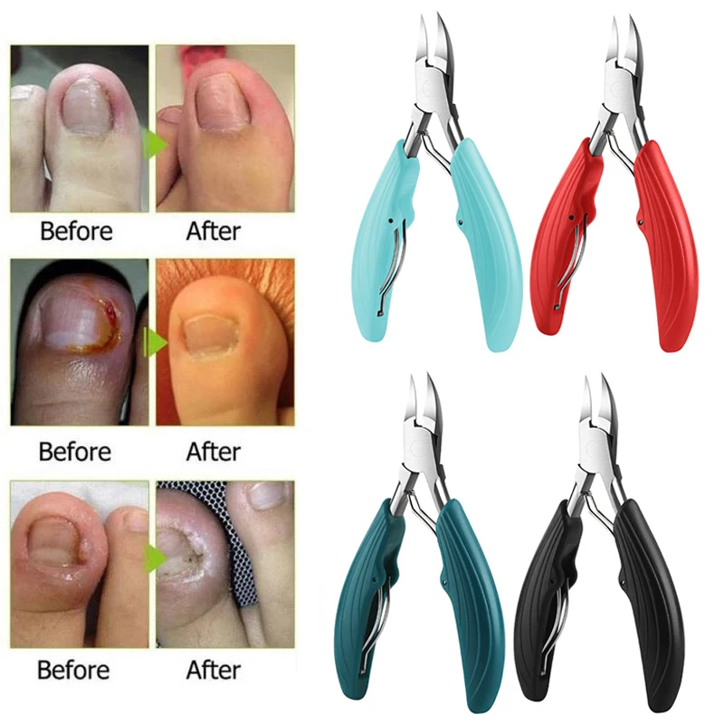 Profissional toe cortador de unhas ferramenta de unhas encravadas unhas grossas removedor de sujeira de pele morta super afiado lâmina curvada ferramentas de unhas